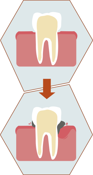 Soins Parodontaux - Cabinet CPI